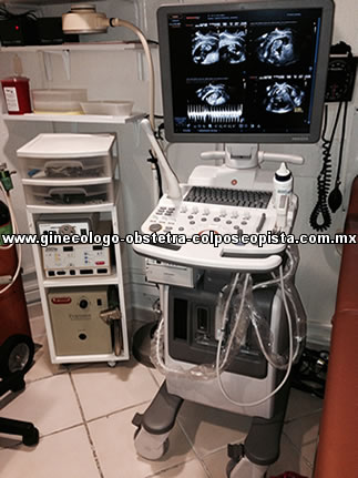 Consulta Embarazo con Ultrasonido en CDMX